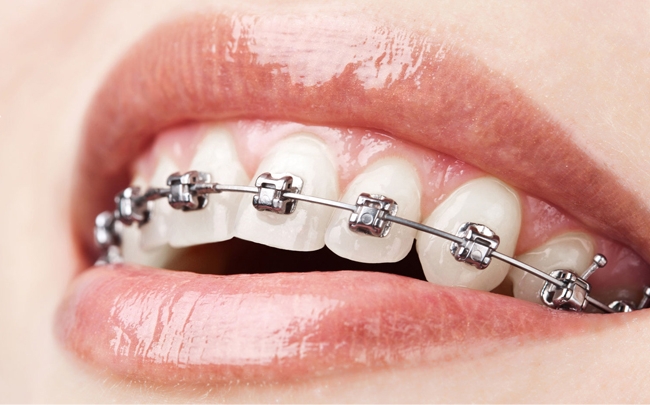 Konsultacje ortodontyczne